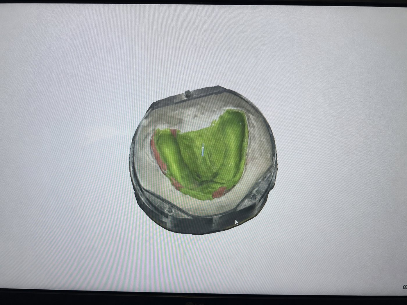 Digital 3D view of the scanned flask and tissue-fitting surface