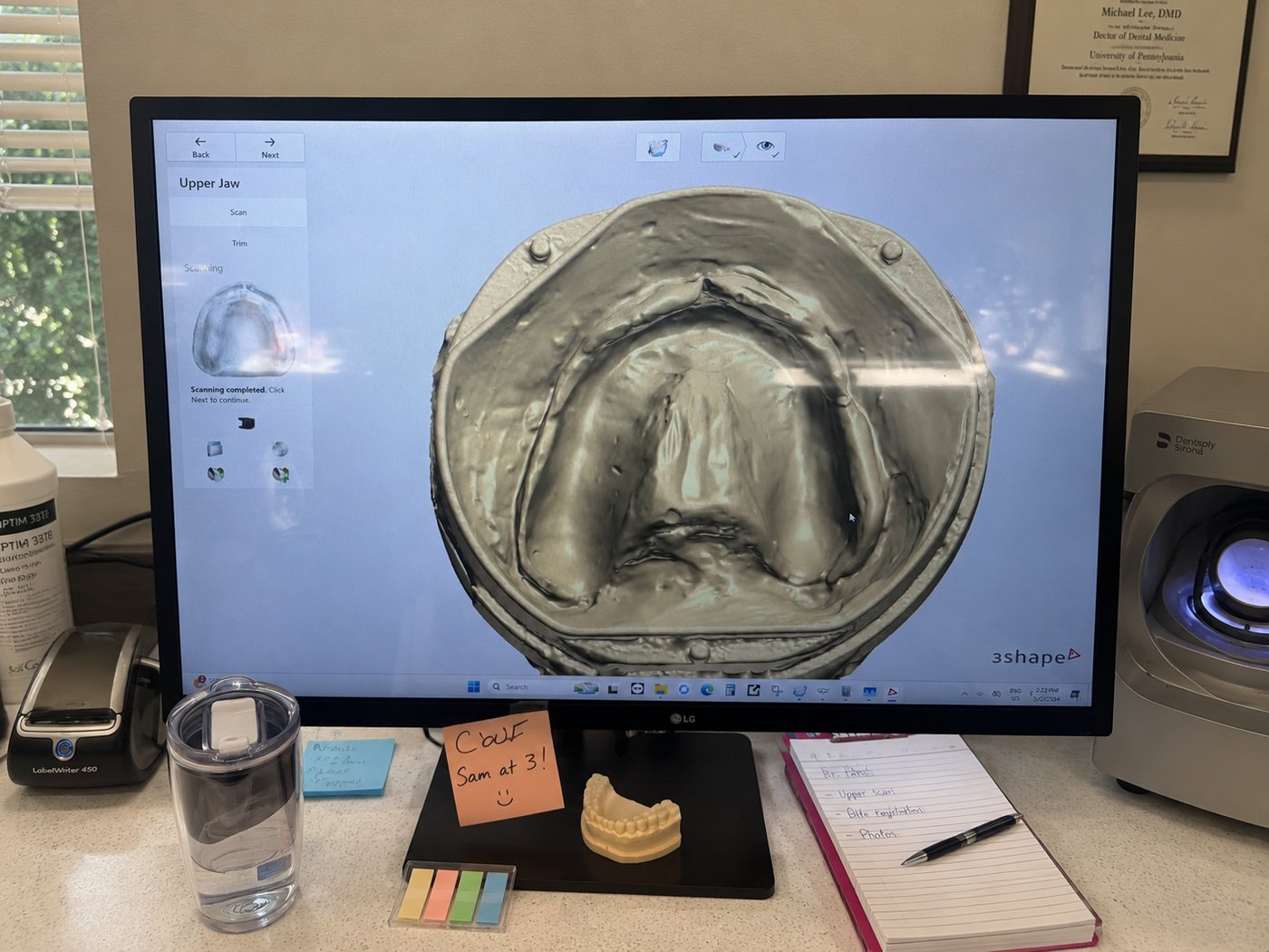 Computer monitor showing the completed flask scan in dental software