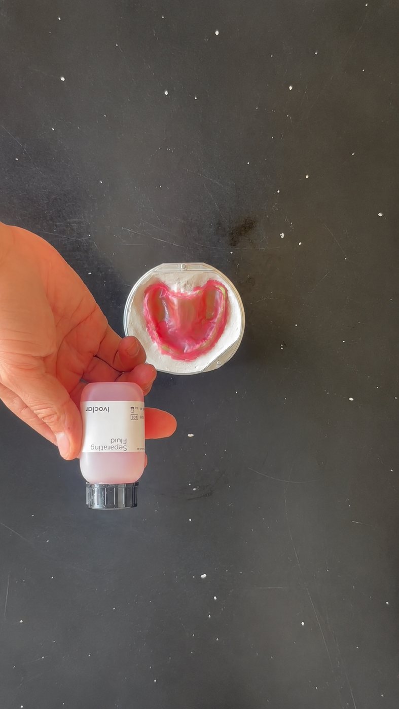 Hand holding Ivoclar separating fluid next to the flask