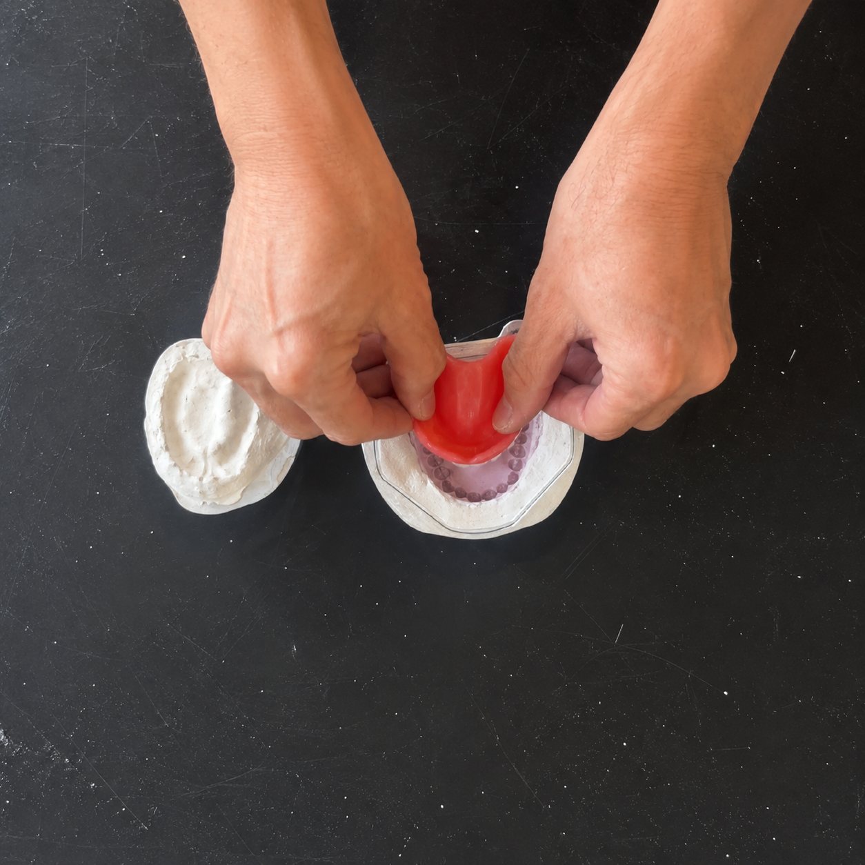 Hands seating a red prosthetic base onto the plaster cast